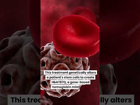 U.S. FDA greelights bluebird bio’s gene therapy lovo-cel for sickle cell disease #GeneEditing #SCD
