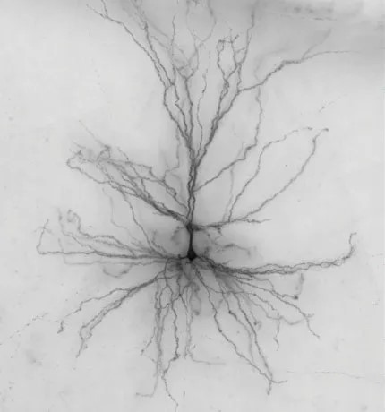 Pig Neurons in Human Brains? The 2025 Reality Check on Neuron Xenotransplantation—Breakthroughs, Risks, and What Happens Next Pig Neurons in Human Brains? The 2025 Reality Check on Neuron Xenotransplantation—Breakthroughs, Risks, and What Happens Next